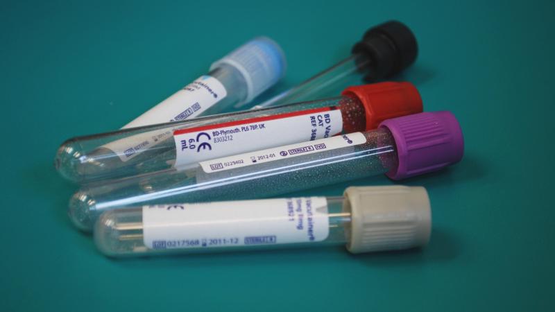 Shaping our portfolio to address health needs related to hepatitis