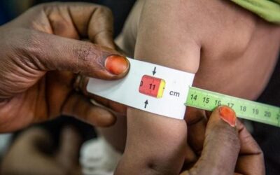 Treatment of 40.000 malnourished children in the past year